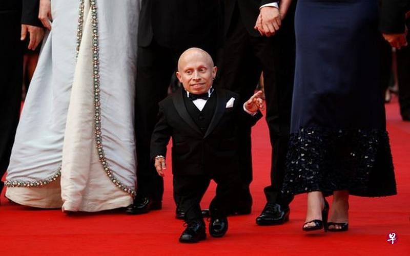 侏儒影星疑轻生享年49